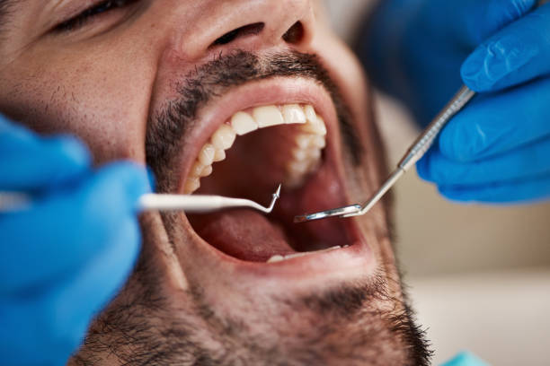 Best Emergency Denture Repair in West Glens Falls, NY